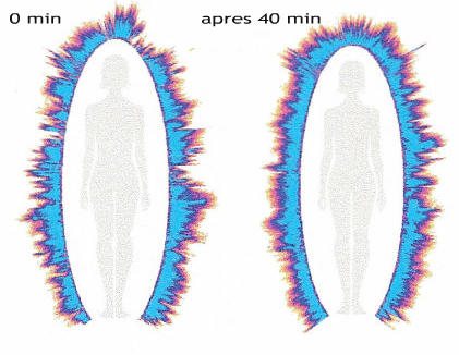 schema aura après 40 min